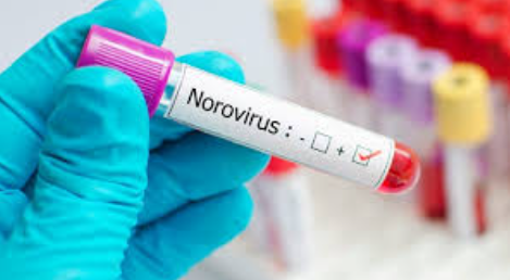 Screenshot 2024-12-30 231534 NOROVIRUS