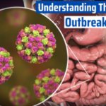 NOROVIRUS OUTBREAK IN USA